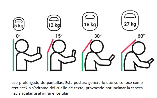 FUERTE IMPACTO DE LAS POSTURAS DE NIÑOS EN EDAD ESCOLAR EN AFECCIONES DE COLUMNA